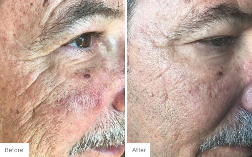 2 - Before and After Real Results image of a man's face.